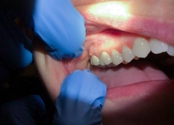 Best Emergency Denture Repair in Shirley, NY