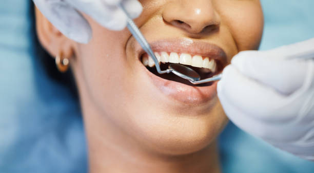 Best Emergency Gum Treatment in Shirley, NY